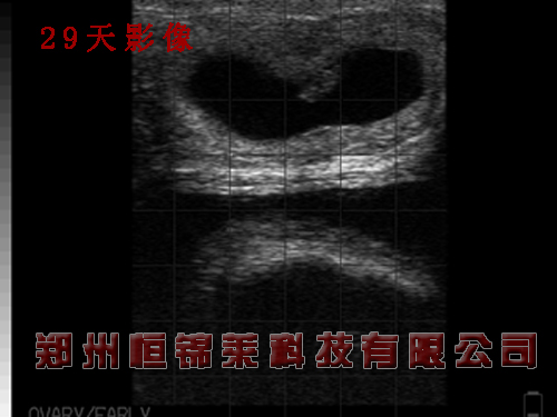 牛用B超影像图