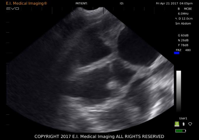 母猪怀孕24天B超图像