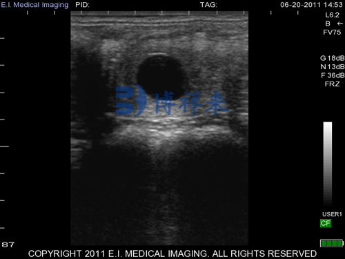 马15天妊娠B超图像