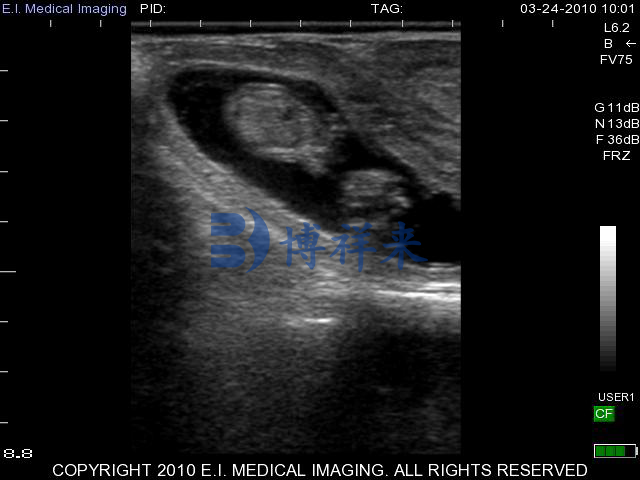 牛用B超机线性直肠探头矩形图像