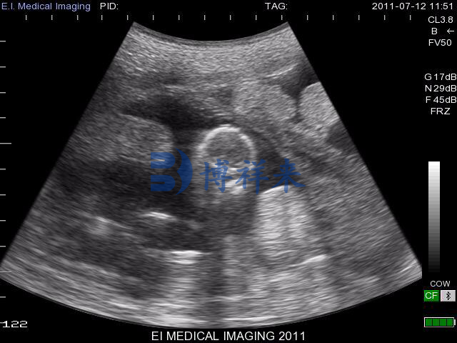 母羊怀孕60多天的超声图像