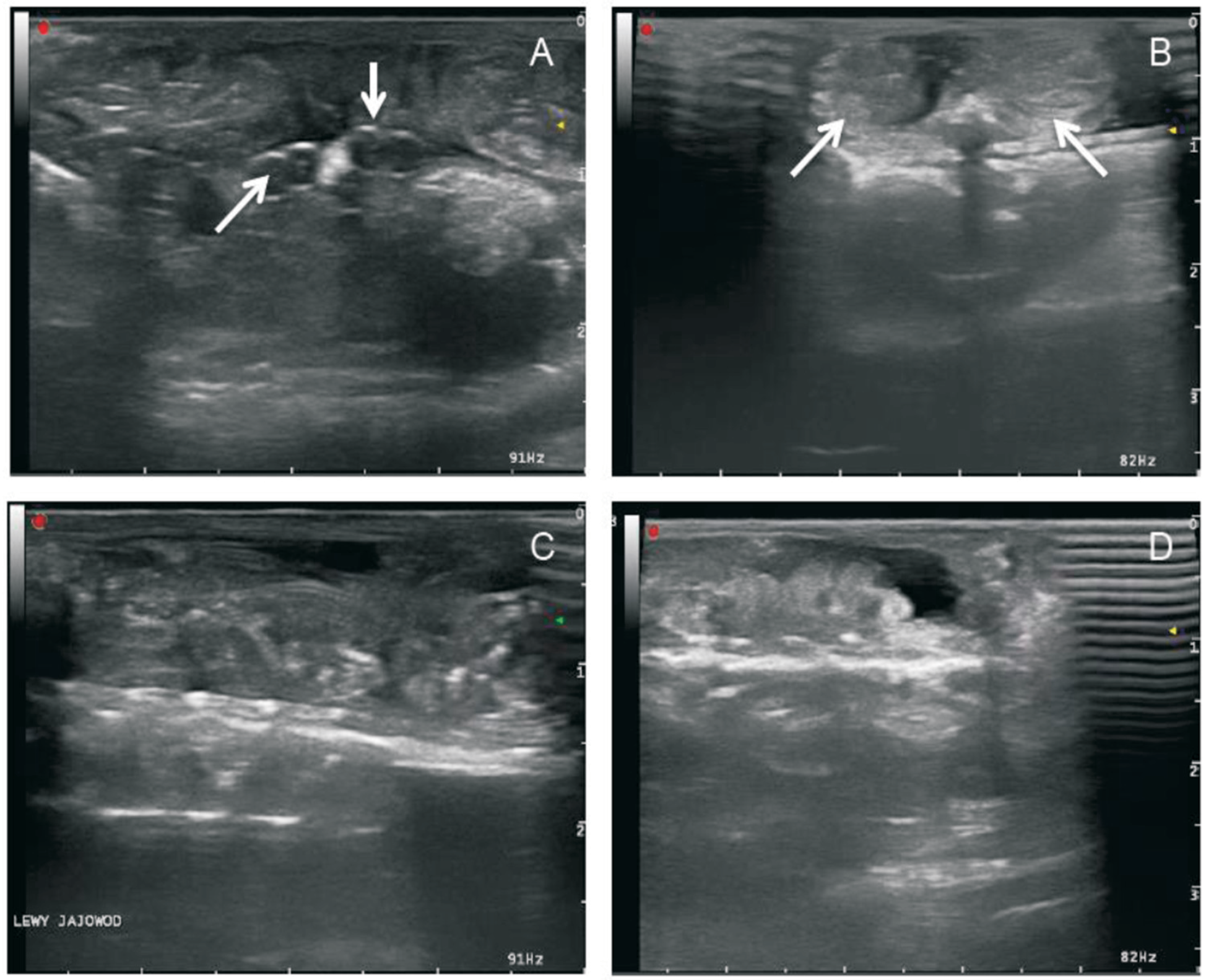 兽用B超机检测火蝾螈怀孕每个阶段超声图像
