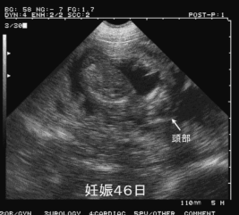 母猪怀孕46天超声图像特点