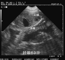 母猪怀孕63天超声图像特点