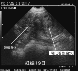 母猪怀孕19天超声图像特点