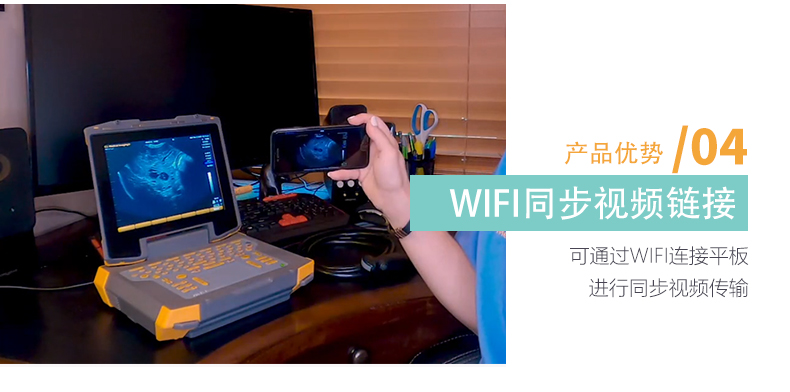 该活体采卵可以无限wifi共享屏幕图像