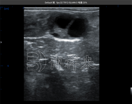 牛用B超机测母牛卵泡大小