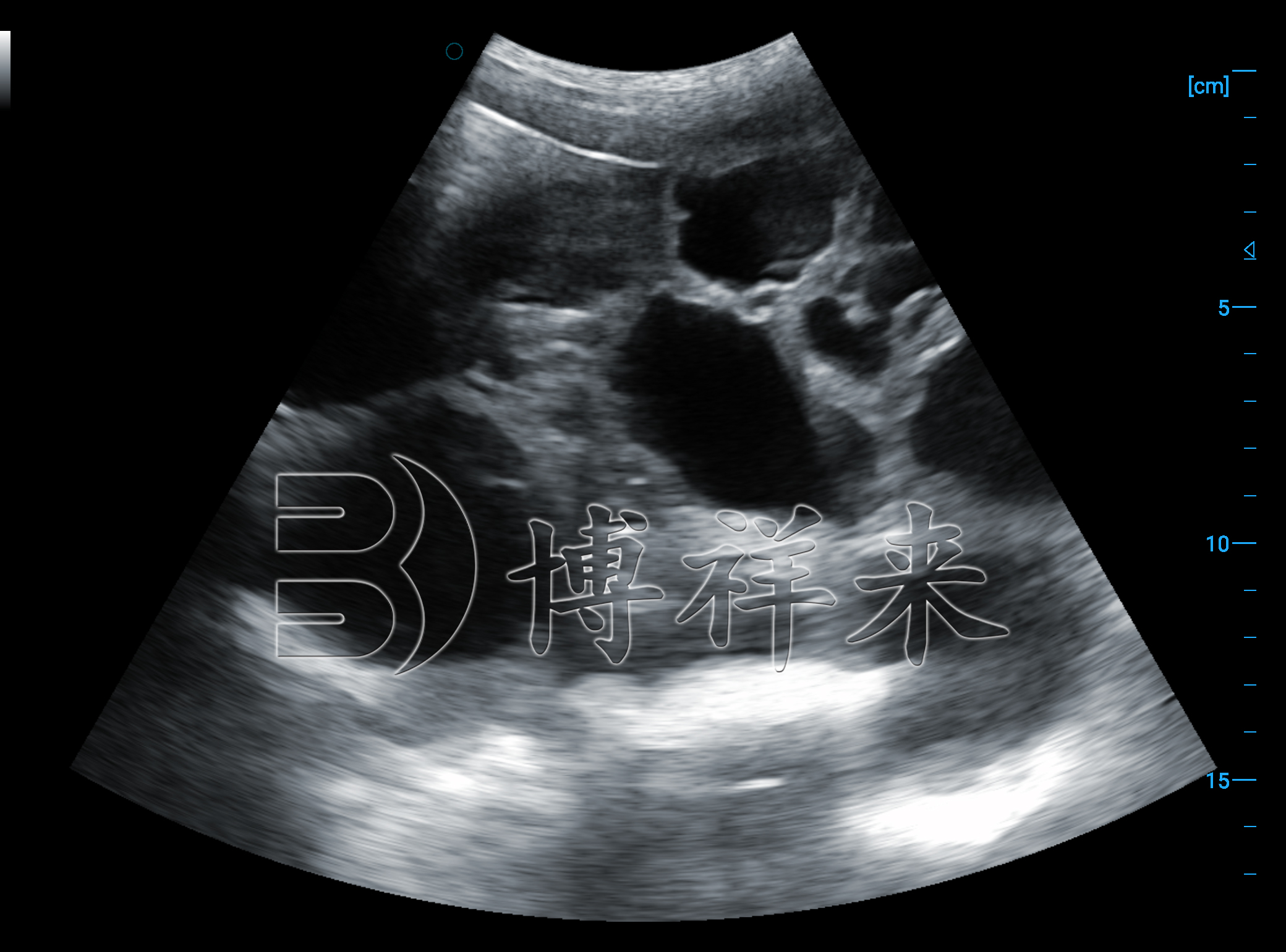 猪怀孕超声图像